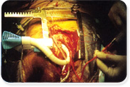  Cardio Thoracic Surgery